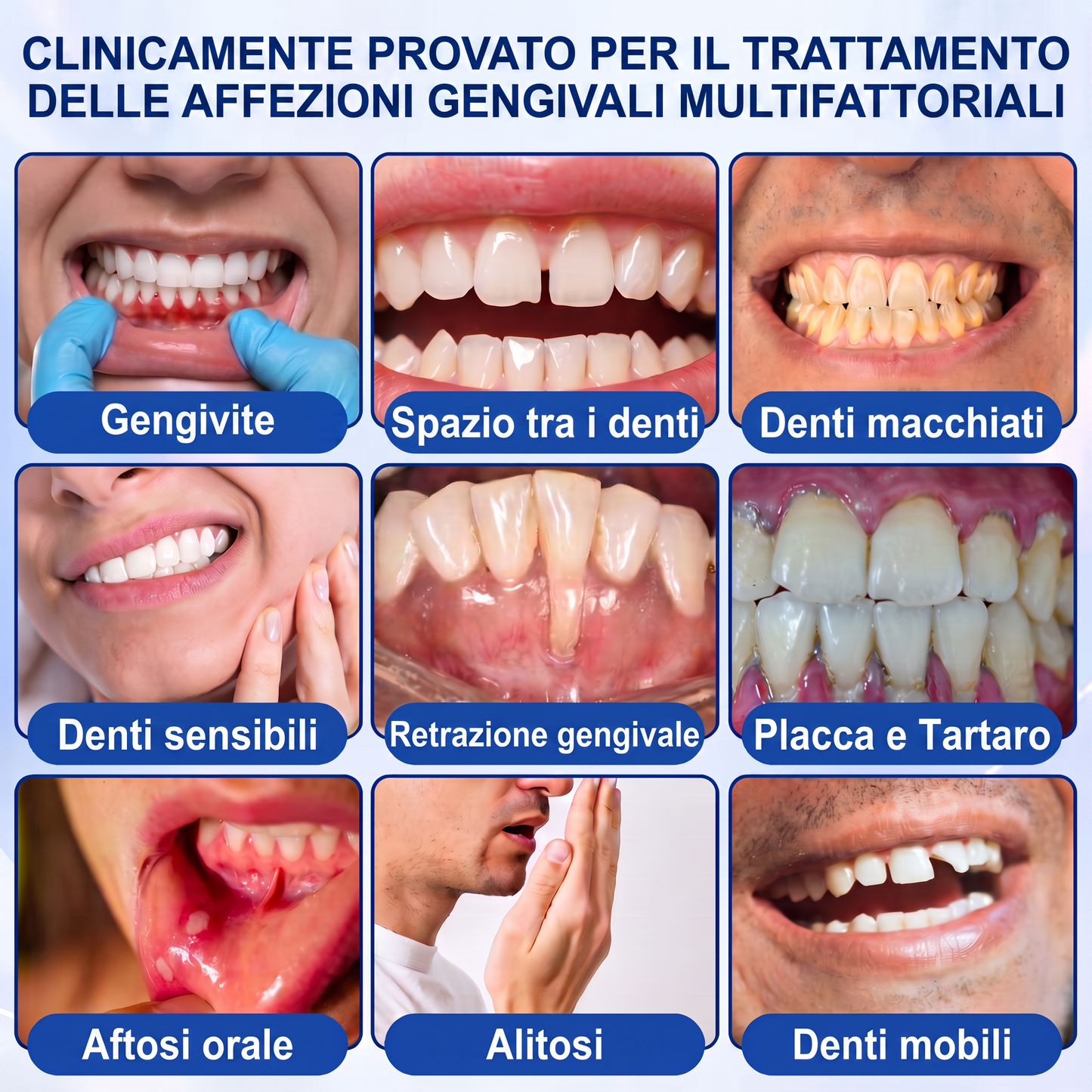 🇮🇹Glimmerly® 🦷GUMREVIVE GEL RIPARATORE PERIODONTALE🏆