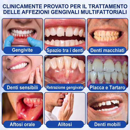 🇮🇹Glimmerly® 🦷GUMREVIVE GEL RIPARATORE PERIODONTALE🏆