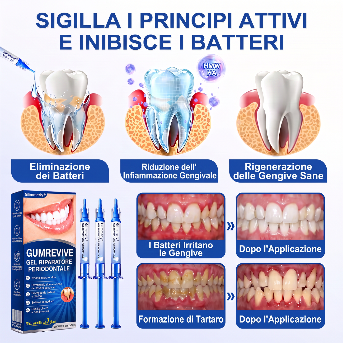 🇮🇹Glimmerly® 🦷GUMREVIVE GEL RIPARATORE PERIODONTALE🏆