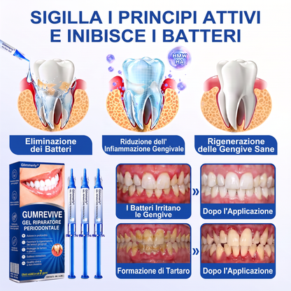 🇮🇹Glimmerly® 🦷GUMREVIVE GEL RIPARATORE PERIODONTALE🏆