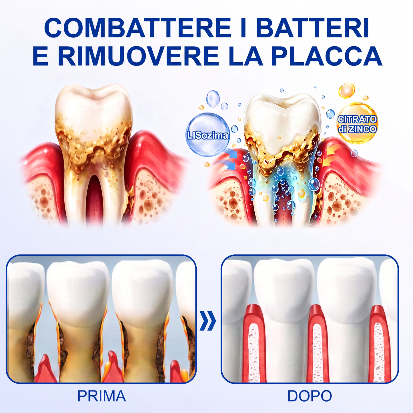 🇮🇹Glimmerly® 🦷GUMREVIVE GEL RIPARATORE PERIODONTALE🏆