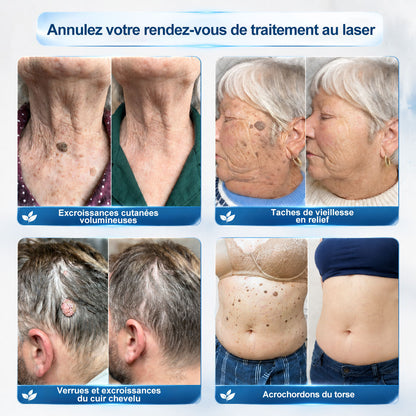 𝐏𝐢𝐜𝐝𝐨® 👨‍⚕️ 𝐒𝐨𝐥𝐮𝐭𝐢𝐨𝐧 𝐜𝐢𝐛𝐥é𝐞 𝟕 𝐣𝐨𝐮𝐫𝐬 𝐩𝐨𝐮𝐫   𝐚𝐜𝐫𝐨𝐜𝐡𝐨𝐫𝐝𝐨𝐧𝐬 𝐞𝐭 𝐢𝐦𝐩𝐞𝐫𝐟𝐞𝐜𝐭𝐢𝐨𝐧𝐬(Roll-on indolore et sans trace)🪉