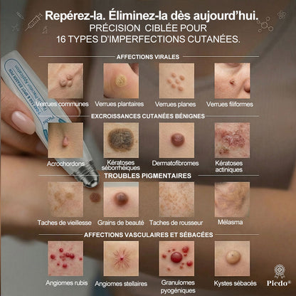 𝐏𝐢𝐜𝐝𝐨® 👨‍⚕️ 𝐒𝐨𝐥𝐮𝐭𝐢𝐨𝐧 𝐜𝐢𝐛𝐥é𝐞 𝟕 𝐣𝐨𝐮𝐫𝐬 𝐩𝐨𝐮𝐫   𝐚𝐜𝐫𝐨𝐜𝐡𝐨𝐫𝐝𝐨𝐧𝐬 𝐞𝐭 𝐢𝐦𝐩𝐞𝐫𝐟𝐞𝐜𝐭𝐢𝐨𝐧𝐬(Roll-on indolore et sans trace)🪉