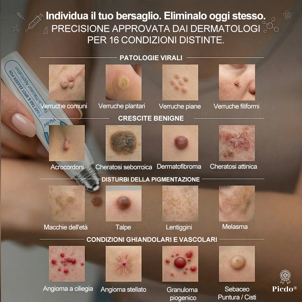 𝐏i𝐜𝐝o® 💡 Soluzione mirata di 7 giorni per la cura degli acrocordoni e delle imperfezioni cutanee (Applicazione indolore con roll-on, senza lasciare segni)