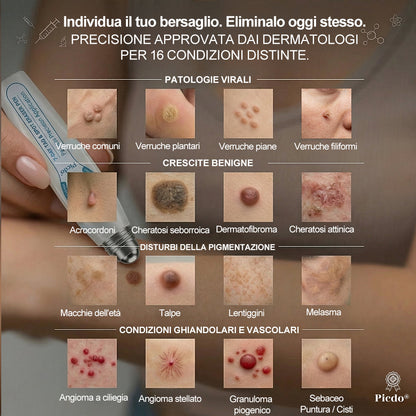 𝐏i𝐜𝐝o® 💡 Soluzione mirata di 7 giorni per la cura degli acrocordoni e delle imperfezioni cutanee (Applicazione indolore con roll-on, senza lasciare segni)